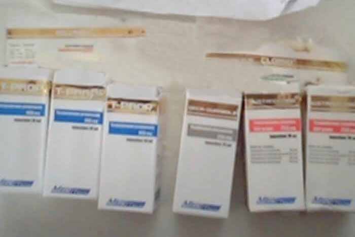 15.02.18 Versalles, Francia